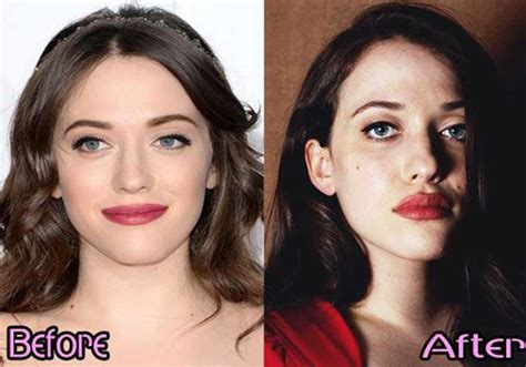 kat dennings breast|Kat Dennings Plastic Surgery Photos [Before & After]